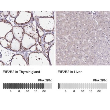 Anti-EIF2B2 antibody produced in rabbit Prestige Antibodies&#174; Powered by Atlas Antibodies, affinity isolated antibody, buffered aqueous glycerol solution