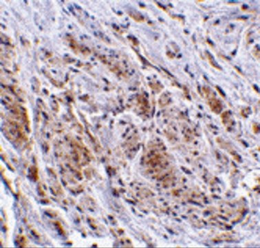 Anti-TRIM5 gamma antibody produced in rabbit affinity isolated antibody