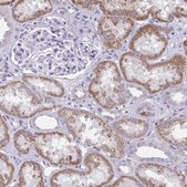 Anti-NNMT antibody produced in rabbit Prestige Antibodies&#174; Powered by Atlas Antibodies, affinity isolated antibody, buffered aqueous glycerol solution