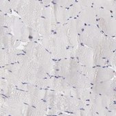 Anti-RNASE1 antibody produced in rabbit Prestige Antibodies&#174; Powered by Atlas Antibodies, affinity isolated antibody, buffered aqueous glycerol solution
