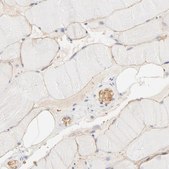 Anti-SPTB antibody produced in rabbit Ab1, Prestige Antibodies&#174; Powered by Atlas Antibodies, affinity isolated antibody, buffered aqueous glycerol solution