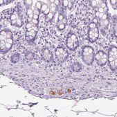 Anti-TH antibody produced in rabbit affinity isolated antibody, buffered aqueous glycerol solution