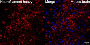 Anti-Neurofilament H Antibody, clone 7L2V7, Rabbit Monoclonal
