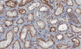 Anti-PKR Antibody, clone 2H14 ZooMAb&#174; Rabbit Monoclonal recombinant, expressed in HEK 293 cells
