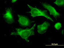 Monoclonal Anti-B2M antibody produced in mouse clone 3F9-2C2, purified immunoglobulin, buffered aqueous solution