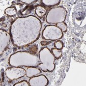 Anti-CALR antibody produced in rabbit Prestige Antibodies&#174; Powered by Atlas Antibodies, affinity isolated antibody, buffered aqueous glycerol solution