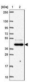 Anti-FNTB antibody produced in rabbit Prestige Antibodies&#174; Powered by Atlas Antibodies, affinity isolated antibody, buffered aqueous glycerol solution