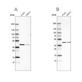 Anti-SORD antibody produced in rabbit Prestige Antibodies&#174; Powered by Atlas Antibodies, affinity isolated antibody, buffered aqueous glycerol solution