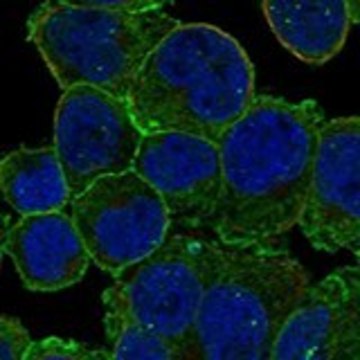 Anti-EPB41 antibody produced in rabbit Prestige Antibodies&#174; Powered by Atlas Antibodies, affinity isolated antibody, buffered aqueous glycerol solution
