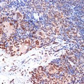 Anti-ALOX5 antibody produced in rabbit