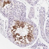 Anti-AQP5 antibody produced in rabbit Prestige Antibodies&#174; Powered by Atlas Antibodies, affinity isolated antibody, buffered aqueous glycerol solution
