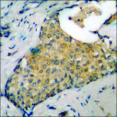 Anti-phospho-PKC &#945; (pTyr658) antibody produced in rabbit affinity isolated antibody