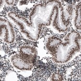 Monoclonal Anti-SMCHD1 antibody produced in mouse Prestige Antibodies&#174; Powered by Atlas Antibodies, clone CL4265, purified immunoglobulin