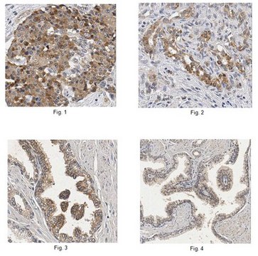 Anti-Olfactomedin-4/OLFM4 Antibody from rabbit, purified by affinity chromatography