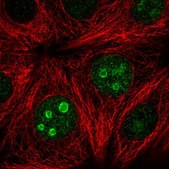Anti-SETD7 antibody produced in rabbit Prestige Antibodies&#174; Powered by Atlas Antibodies, affinity isolated antibody, buffered aqueous glycerol solution