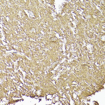 Anti-CD90/Thy1 Antibody, clone 2V9S6, Rabbit Monoclonal