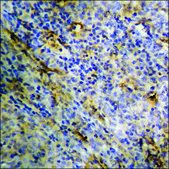 Anti-phospho-PKC &#950; (pThr410) antibody produced in rabbit affinity isolated antibody