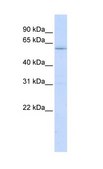 Anti-LRRC15 antibody produced in rabbit affinity isolated antibody