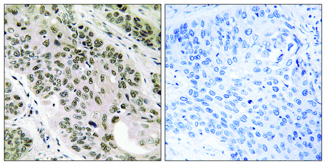 Anti-TNNI3K antibody produced in rabbit affinity isolated antibody
