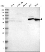 Anti-Hdac10 Antibody Produced In Rabbit Prestige Antibodies&#174; Powered by Atlas Antibodies, affinity isolated antibody, buffered aqueous glycerol solution