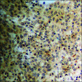 Anti-phospho-PPAR-&#947; (pSer112) antibody produced in rabbit affinity isolated antibody