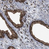 Anti-VCP antibody produced in rabbit Prestige Antibodies&#174; Powered by Atlas Antibodies, affinity isolated antibody, buffered aqueous glycerol solution