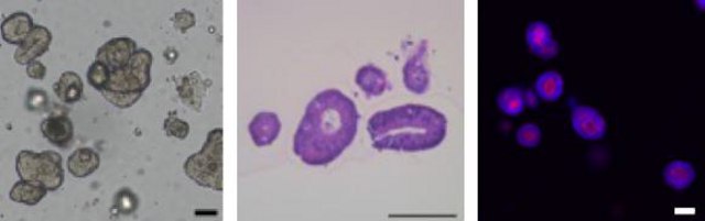 3dGRO&#174; Human CRC Organoids (ISO57)