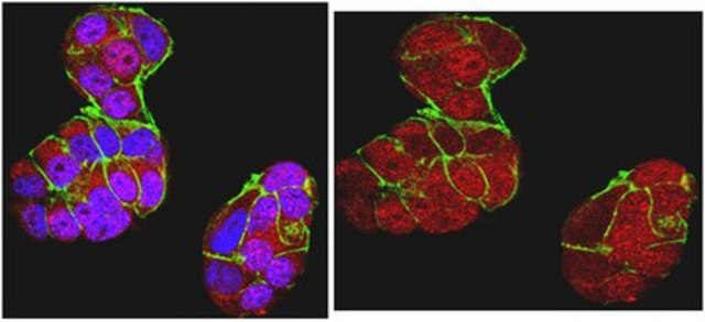 Anti-BRCA1 Antibody, clone MS110 clone MS110, from mouse