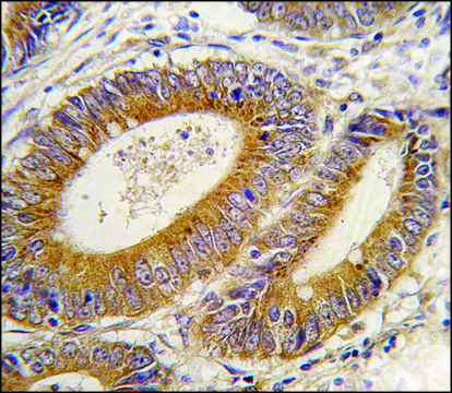 Anti-YARS2 (N-term) antibody produced in rabbit saturated ammonium sulfate (SAS) precipitated, buffered aqueous solution