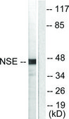 Anti-NSE antibody produced in rabbit affinity isolated antibody