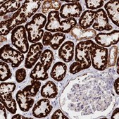 Anti-AKTIP antibody produced in rabbit Prestige Antibodies&#174; Powered by Atlas Antibodies, affinity isolated antibody, buffered aqueous glycerol solution