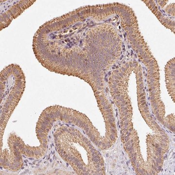 Anti-RAB35 antibody produced in rabbit Prestige Antibodies&#174; Powered by Atlas Antibodies, affinity isolated antibody, buffered aqueous glycerol solution