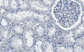 Anti-Clathrin Heavy Chain Antibody, clone 1C6 ZooMAb&#174; Rabbit Monoclonal recombinant, expressed in HEK 293 cells