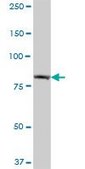 Anti-EHHADH antibody produced in mouse IgG fraction of antiserum, buffered aqueous solution