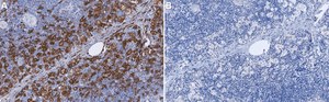 Anti-CD163 Antibody, clone MAC2-158