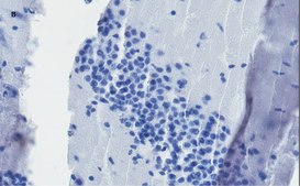 Anti-c-Fos Antibody, clone 1D10, ZooMAb&#174; Rabbit Monoclonal recombinant, expressed in HEK 293 cells