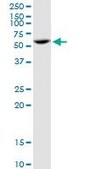 Anti-PPP2R5A antibody produced in mouse IgG fraction of antiserum, buffered aqueous solution