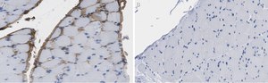Anti-Fibroblast Antibody, clone TE-7 ZooMAb&#174; Mouse Monoclonal recombinant, expressed in HEK 293 cells
