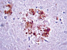 Anti-APP A4 Antibody, a.a. 66-81 of APP {NT}, clone 22C11 clone 22C11, Chemicon&#174;, from mouse