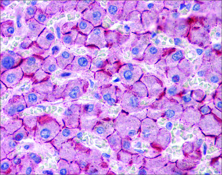 Anti-CDH1 antibody produced in rabbit affinity isolated antibody