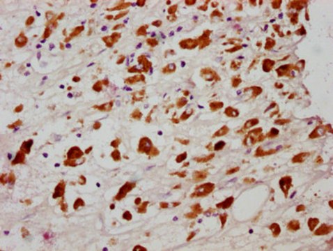 Anti-phospho-MLKL (S358) antibody, clone 4A6, Rabbit Monoclonal recombinant, expressed in HEK293F cells