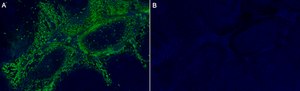 Anti-S100-A9/MRP14 Antibody, clone 1M6 ZooMAb&#174; Rabbit Monoclonal recombinant, expressed in HEK 293 cells