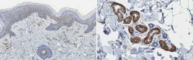 Anti-CD44 Antibody, clone Hermes-1 clone Hermes-1, from rat