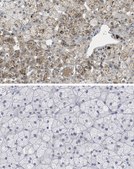 Anti-CCL4/MIP1&#946; Antibody, clone 4G11.10.5