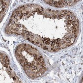Anti-LARP4B antibody produced in rabbit Prestige Antibodies&#174; Powered by Atlas Antibodies, affinity isolated antibody, buffered aqueous glycerol solution