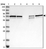 Anti-SNX2 antibody produced in rabbit Prestige Antibodies&#174; Powered by Atlas Antibodies, affinity isolated antibody, buffered aqueous glycerol solution