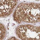 Anti-KIF5B antibody produced in rabbit Prestige Antibodies&#174; Powered by Atlas Antibodies, affinity isolated antibody