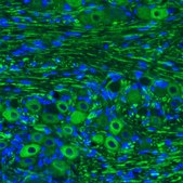 Monoclonal Anti-NEFM antibody produced in mouse Prestige Antibodies&#174; Powered by Atlas Antibodies, clone CL2688, purified immunoglobulin, buffered aqueous glycerol solution