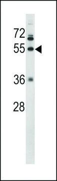 ANTI-FIBG(C-TERMINAL) antibody produced in rabbit purified immunoglobulin, buffered aqueous solution