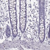 ANTI-NPTXR antibody produced in rabbit Prestige Antibodies&#174; Powered by Atlas Antibodies, affinity isolated antibody, buffered aqueous glycerol solution